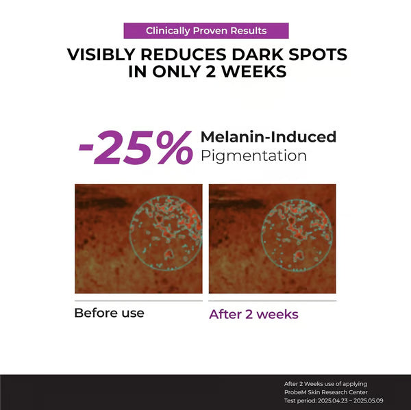 Niacinamide 20 Serum--2 Weeks to Radiant Skin! Banish Dullness, Embrace Flawless Glow! 💖