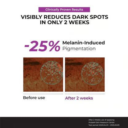 Niacinamide 20 Serum--2 Weeks to Radiant Skin! Banish Dullness, Embrace Flawless Glow! 💖